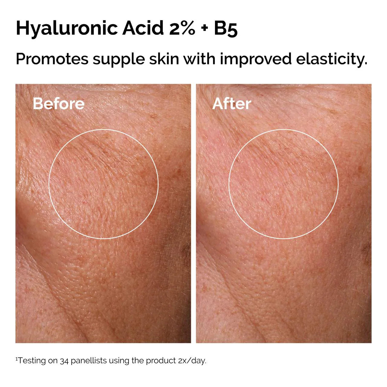 THE ORDINARY The Skin Support Set with Niacinamide + Hyaluronic Acid