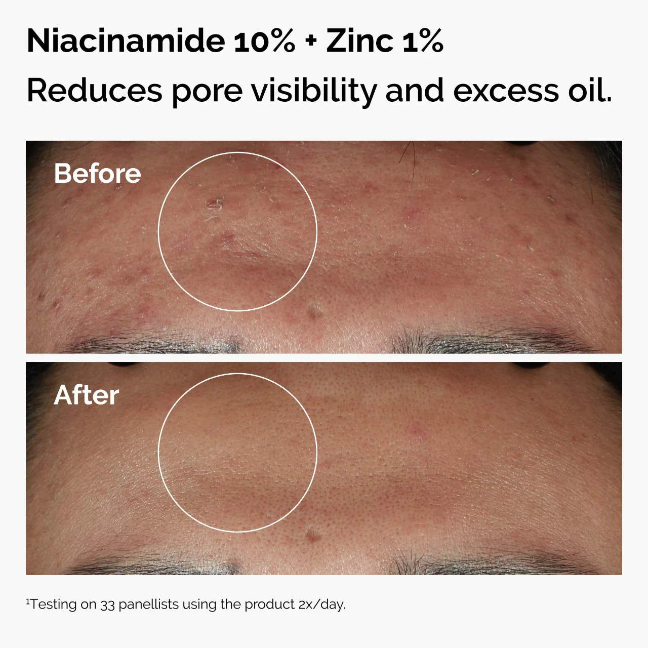 THE ORDINARY The Skin Support Set with Niacinamide + Hyaluronic Acid