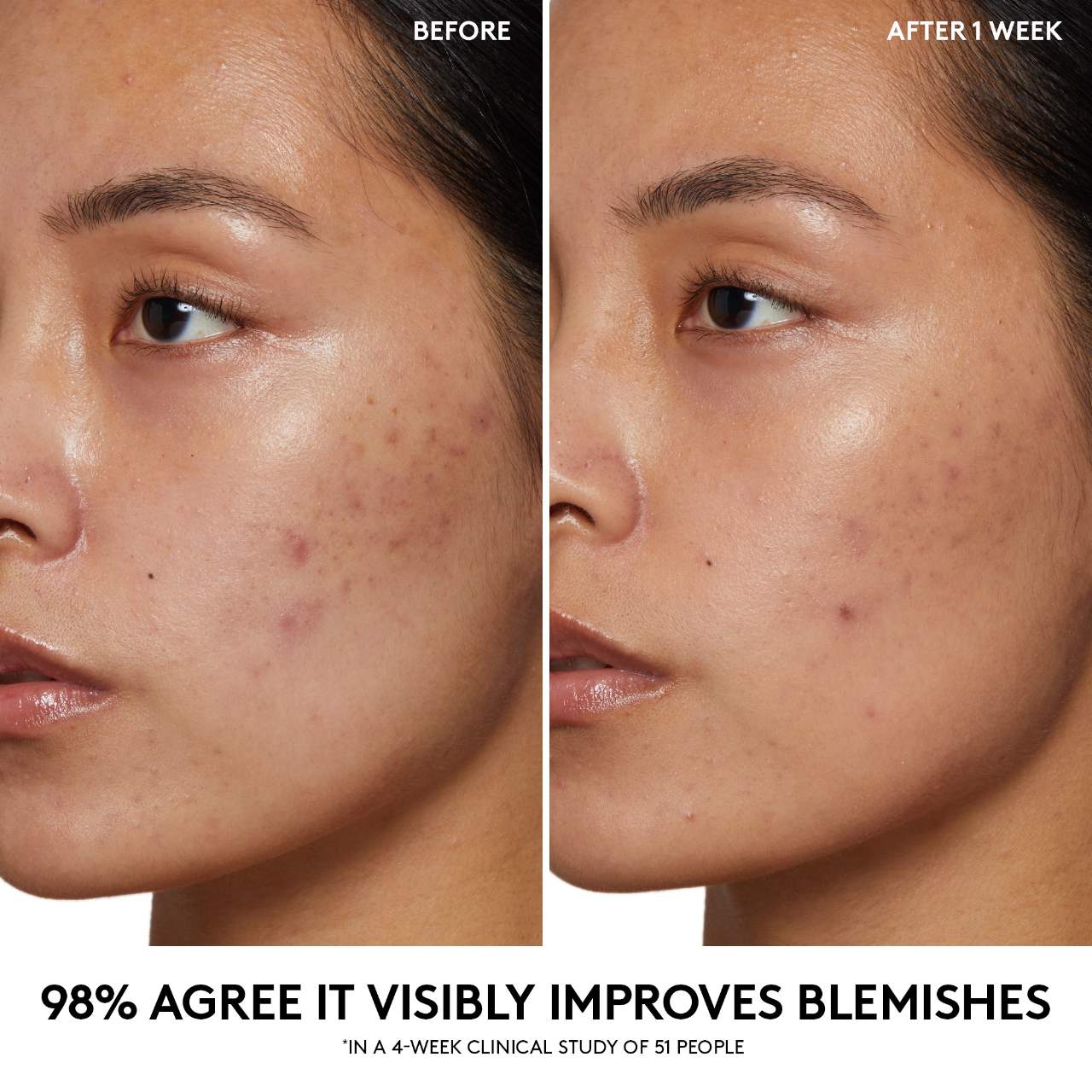 Fenty Beauty Cherry Dub Pore Purify’r Gel Cleanser *PRE-ORDER*