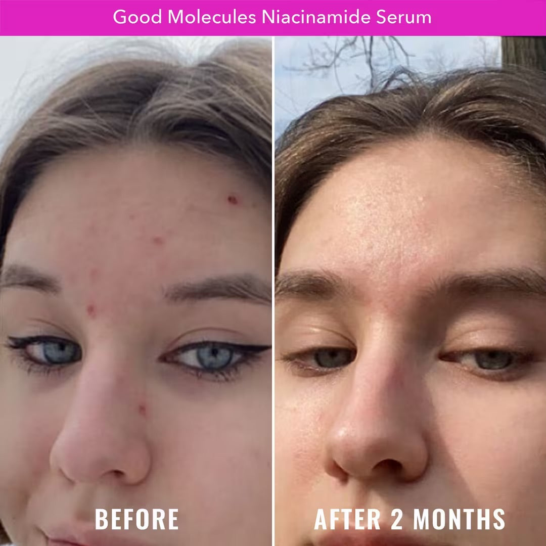 GOOD MOLECULES NIACINAMIDE SERUM 30ML *PRE ORDER*
