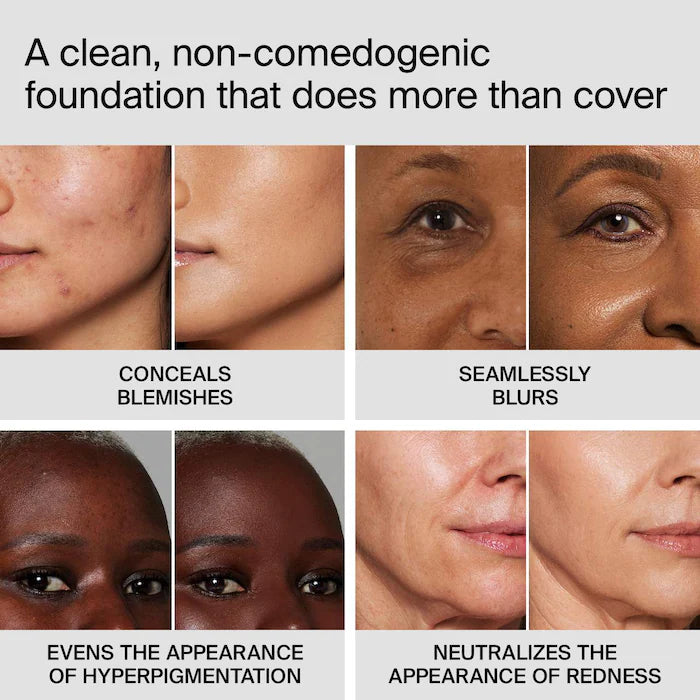 TRICLONE™ SKIN TECH MEDIUM COVERAGE FOUNDATION