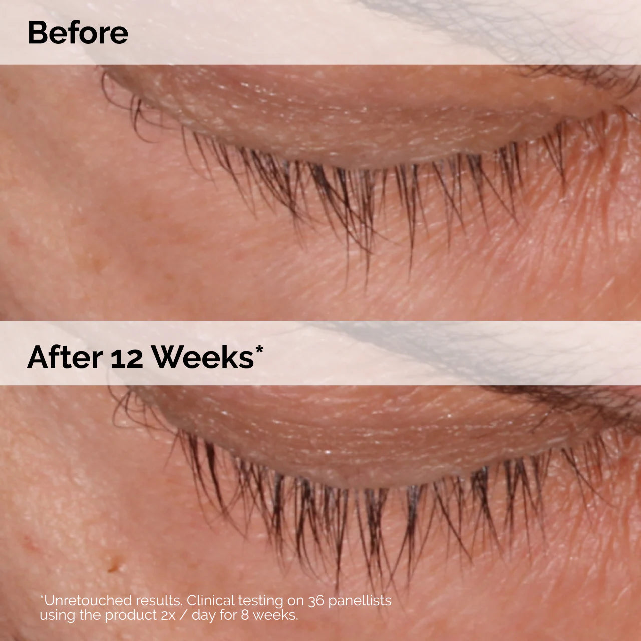 The Ordinary
Multi-Peptide Lash and Brow Serum